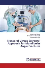 Transoral Versus Extraoral Approach for Mandibular Angle Fractures - Mohammad Akheel
