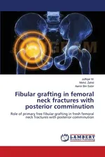 Fibular grafting in femoral neck fractures with posterior comminution - Julfiqar M.