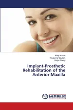 Implant-Prosthetic Rehabilitation of the Anterior Maxilla - Kelly Norton