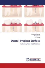Dental Implant Surface - Shrimant Raman