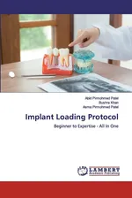 Implant Loading Protocol - Abid Pirmohmed Patel