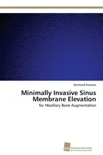 Minimally Invasive Sinus Membrane Elevation - Bernhard Pommer