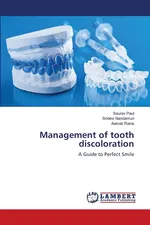 Management of tooth discoloration - Saurav Paul