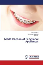Mode d'action of Functional Appliances - Manali Jadhav