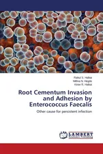 Root Cementum Invasion and Adhesion by Enterococcus Faecalis - Rahul S. Halkai