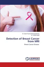 Detection of Breast Cancer from MRI - Dr. Samir Kumar Bandyopadhyay