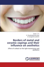Borders of Metal and Ceramic Copings and Their Influence on Aesthetics - P. Pavan T.