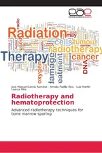 Radiotherapy and hematoprotection - Ramírez José Manuel García