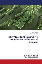 Microbial biofilm and its relation to periodontal disease - Nikita Gupta