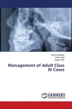 Management of Adult Class III Cases - Harsha Mahajan