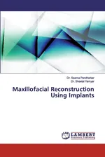 Maxillofacial Reconstruction Using Implants - Dr. Sheetal Yamyar