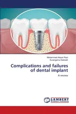 Complications and failures of dental implant - Mohammed Ahsan Razi
