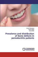 Prevalence and distribution of bone defects in periodontitis patients - SHIVANI SACHDEVA