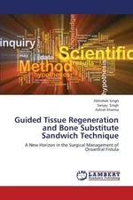 Guided Tissue Regeneration and Bone Substitute Sandwich Technique - Abhishek Singh