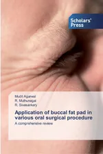 Application of buccal fat pad in various oral surgical procedure - Mudit Agarwal