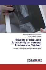 Fixation of Displaced Supracondylar Humeral Fractures in Children - Naeem Mohamed Mahmoud Gamil