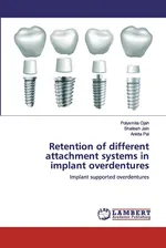 Retention of different attachment systems in implant overdentures - Polysmita Ojah