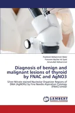 Diagnosis of benign and malignant lesions of thyroid by FNAC and AgNO3 - Abdul Rasheed Mohammed
