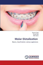Molar Distalization - Rashmi Patil