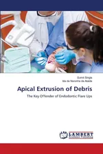 Apical Extrusion of Debris - Sumit Singla