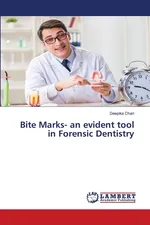 Bite Marks- an evident tool in Forensic Dentistry - Deepika Chari