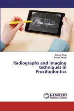 Radiographs and Imaging techniques in Prosthodontics - Bhavna Ahuja
