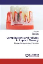 Complications and Failures in Implant Therapy - Tanvi Ohri