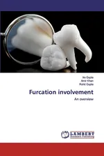 Furcation involvement - Ira Gupta