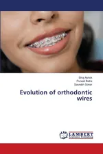 Evolution of orthodontic wires - Shoj Ashok