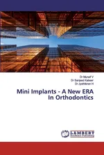 Mini Implants - A New ERA In Orthodontics - Dr Munaif V