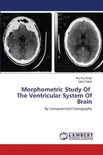 Morphometric Study Of The Ventricular System Of Brain - Brij Raj Singh