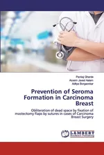 Prevention of Seroma Formation in Carcinoma Breast - Pankaj Gharde