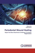Periodontal Wound Healing - Bhavna Jha