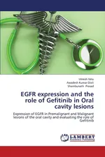 EGFR expression and the role of Gefitinib in Oral cavity lesions - Umesh Velu