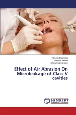 Effect of Air Abrasion On Microleakage of Class V cavities - Umesh Dharmani