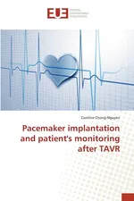 Pacemaker implantation and patient's monitoring after TAVR - Caroline Chong-Nguyen