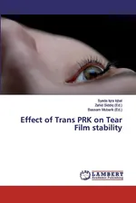 Effect of Trans PRK on Tear Film stability - Syeda Iqra Iqbal