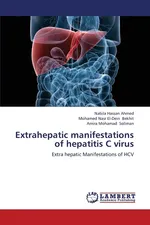 Extrahepatic Manifestations of Hepatitis C Virus - Nabila Hassan Ahmed
