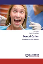 Dental Caries - Kirti Raina