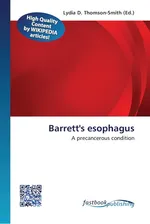 Barrett's esophagus