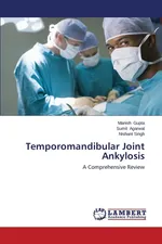 Temporomandibular Joint Ankylosis - Manish Gupta