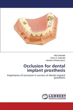 Occlusion for Dental Implant Prosthesis - Nitai Debnath