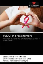 PET/CT in breast tumors - Macias José Antonio Serna