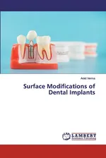 Surface Modifications of Dental Implants - Ankit Verma