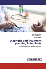 Diagnosis and treatment planning in implants - Kunal Gaurav Seth