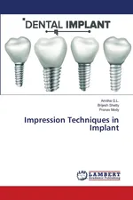 Impression Techniques in Implant - Amitha G.L.