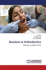 Brackets in Orthodontics - V. Anisha