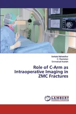 Role of C-Arm as Intraoperative Imaging in ZMC Fractures - Venkata Maheedhar
