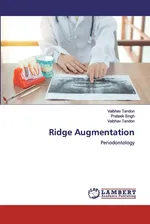 Ridge Augmentation - Vaibhav Tandon