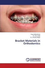 Bracket Materials in Orthodontics - Divya Maheshwari
